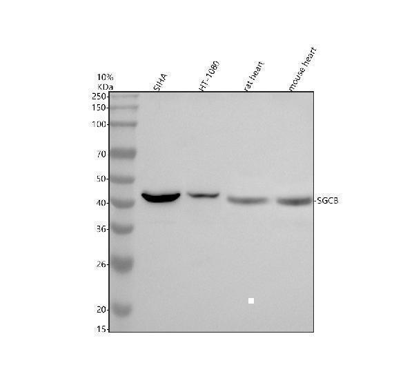  Western blot analysis of Beta Sarcoglycan/SGCB using anti-Beta Sarcoglycan/SGCB antibody (A07064-2)
