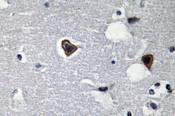 Immunohistochemistry (IHC) analyzes of Sarcoglycan-β (V136) pAb in paraffin-embedded human brain tissue