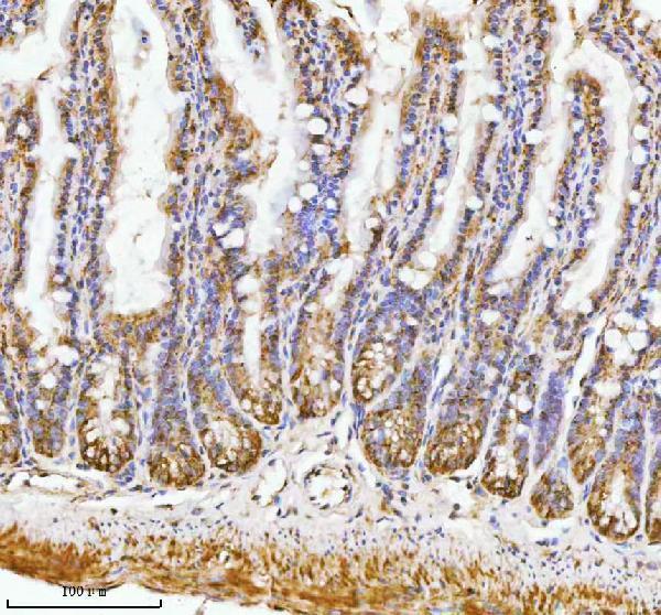  IHC analysis of PAFAH1B2 using anti-PAFAH1B2 antibody (A07067)