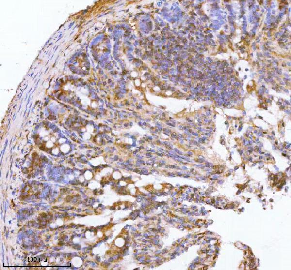  IHC analysis of PAFAH1B2 using anti-PAFAH1B2 antibody (A07067)
