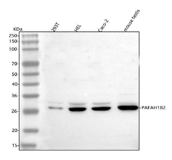  Western blot analysis of PAFAH1B2 using anti-PAFAH1B2 antibody (A07067)