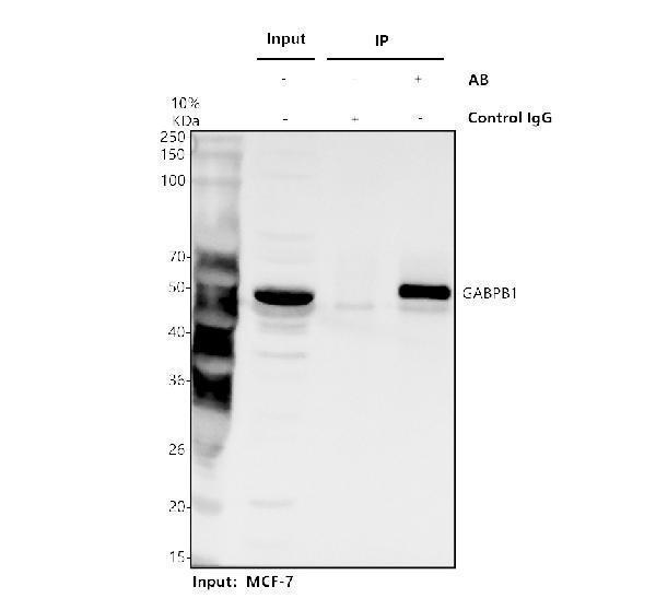 Immunoprecipitating GABPB1 in MCF-7 whole cell lysate