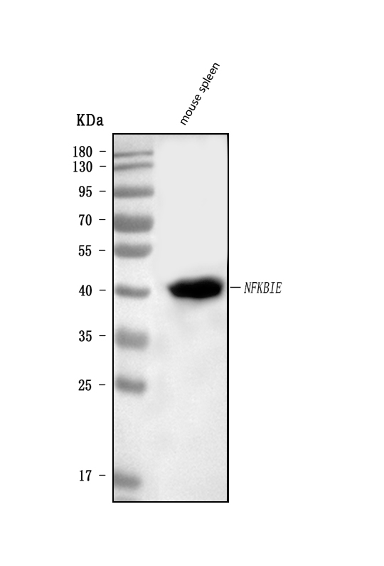  Western blot analysis of IKB epsilon/Nfkbie using anti-IKB epsilon/Nfkbie antibody (A07073-1)
