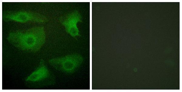 a07073s22 1 nfkbie primary antibodies if testing 4