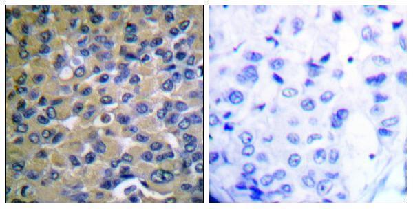 a07073s22 1 nfkbie primary antibodies ihc testing 3