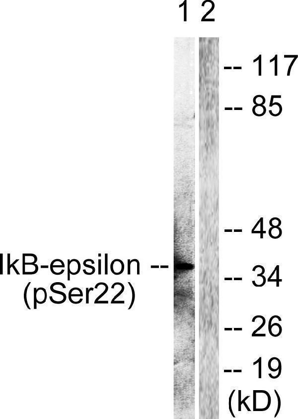 a07073s22 1 nfkbie primary antibodies wb testing 2