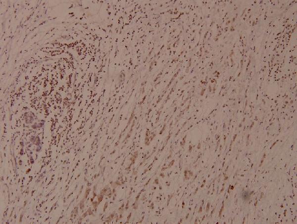 a07073s22 nfkbie primary antiboties ihc testing 2