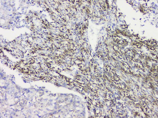 a07074 1 rrbp1 primary antibodies ihc testing 4