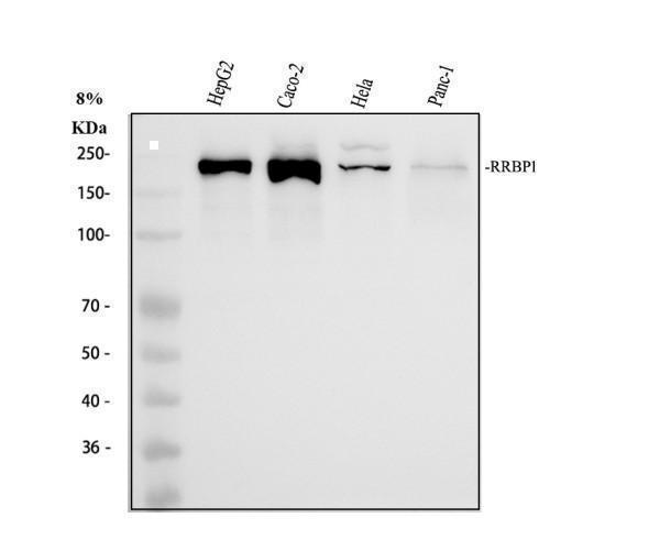Western blot analysis of RRBP1 using anti-RRBP1 antibody (A07074-1)