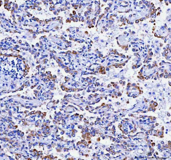  IHC analysis of RRBP1 using anti-RRBP1 antibody (A07074-2)
