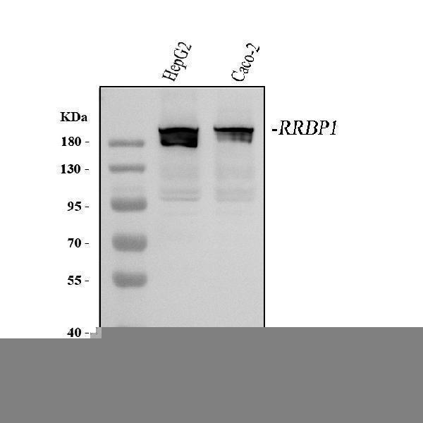  Western blot analysis of RRBP1 using anti-RRBP1 antibody (A07074-2)