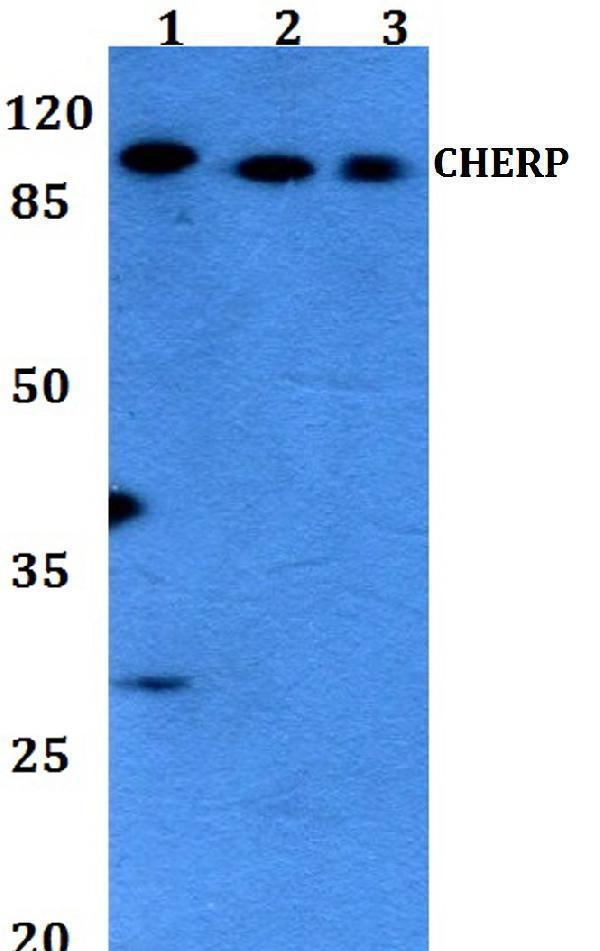 a07075 cherp primary antiboties wb testing 1