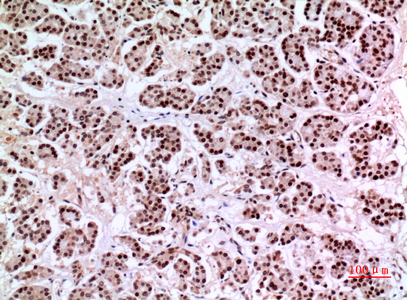 a07076 1 klf13 primary antibodyes ihc testing 3