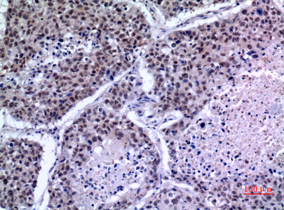 a07076 1 klf13 primary antibodyes ihc testing 4
