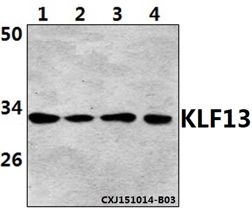 Western blot (WB) analysis of KLF13 (Acetyl-K166) polyclonal antibodyat 1:500 dilution
Lane1:Hela whole cell lysate(40ug)
Lane2:Jurkat whole cell lysate(40ug)
Lane3:NIH-3T3 whole cell lysate(40ug)
Lane4:PC12 whole cell lysate(40ug)