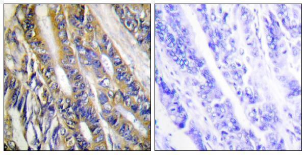 a07077 1 dgkh primary antibodies ihc testing 2