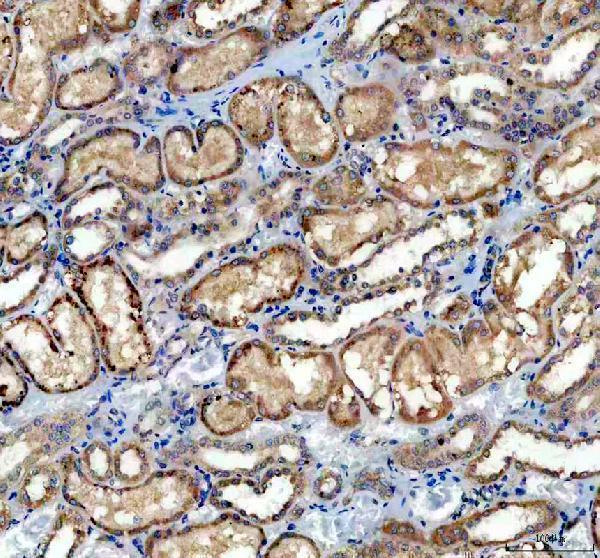 IHC analysis of DGKH using anti-DGKH antibody (A07077-3)