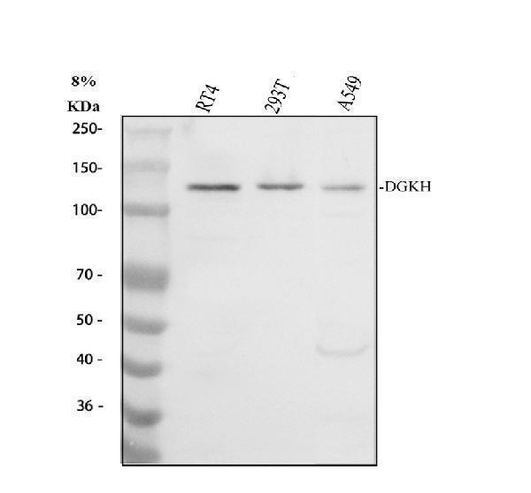 Western blot analysis of DGKH using anti-DGKH antibody (A07077-3)