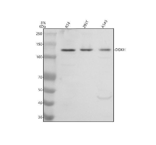 Western blot analysis of DGKH using anti-DGKH antibody (A07077-3)