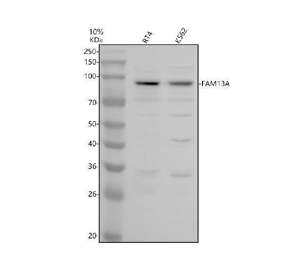 Western blot analysis of FAM13A using anti-FAM13A antibody (A07079-1)