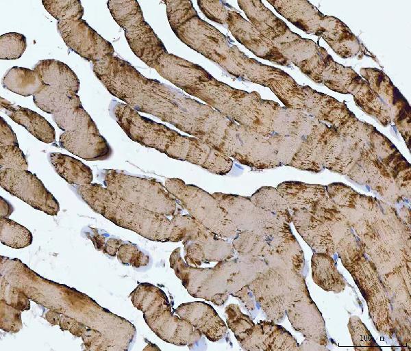  IHC analysis of TNNI1 using anti-TNNI1 antibody (A07080-1)