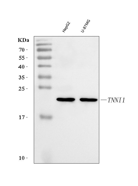  Western blot analysis of TNNI1 using anti-TNNI1 antibody (A07080-1)