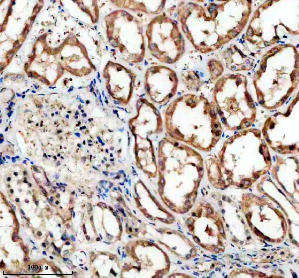 IHC analysis of SLC6A12 using anti-SLC6A12 antibody (A07083-1)
