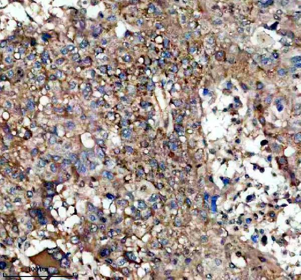 IHC analysis of SLC6A12 using anti-SLC6A12 antibody (A07083-1)
