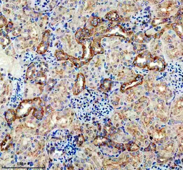 a07083 1 slc6a12 primary antibodies ihc testing 3