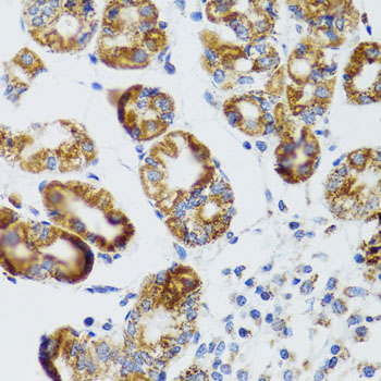 Immunohistochemistry of paraffin-embedded human liver damage using RIPK4 antibody  at dilution of 1:100 