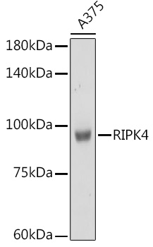 Western blot analysis of extracts of A375 cells, using RIPK4 Rabbit pAb  at 1:1000 dilution