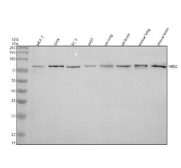 Western blot analysis of MID2 using anti-MID2 antibody (A07086-2)