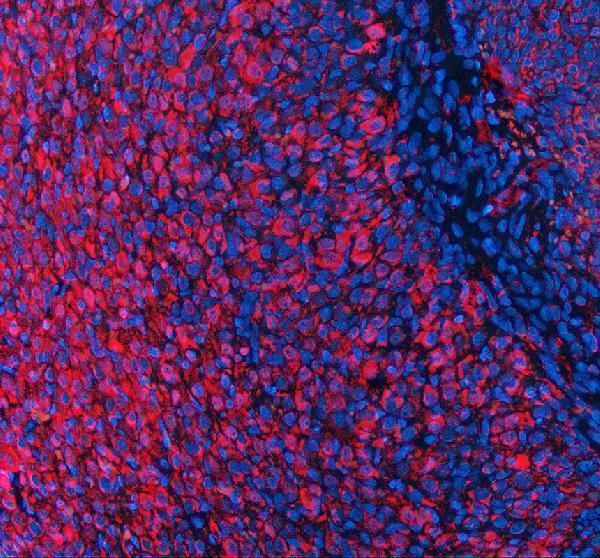 a07088 1 evc2 primary antibodies if testing 1