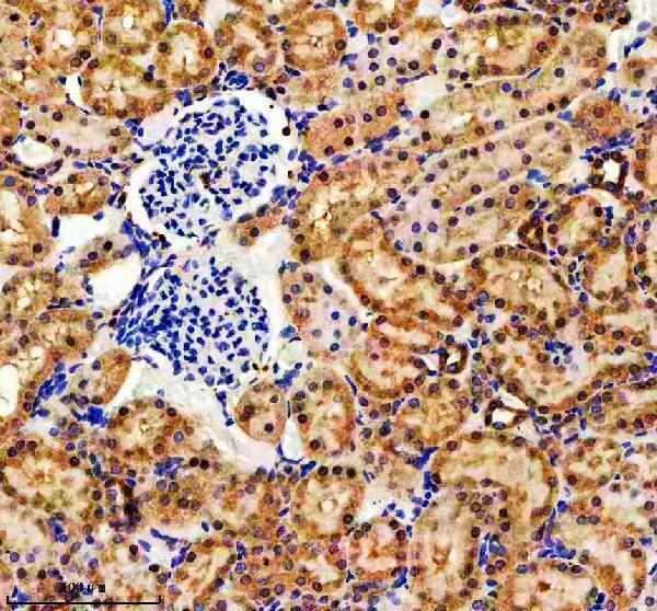 IHC analysis of EVC2 using anti-EVC2 antibody (A07088-1)