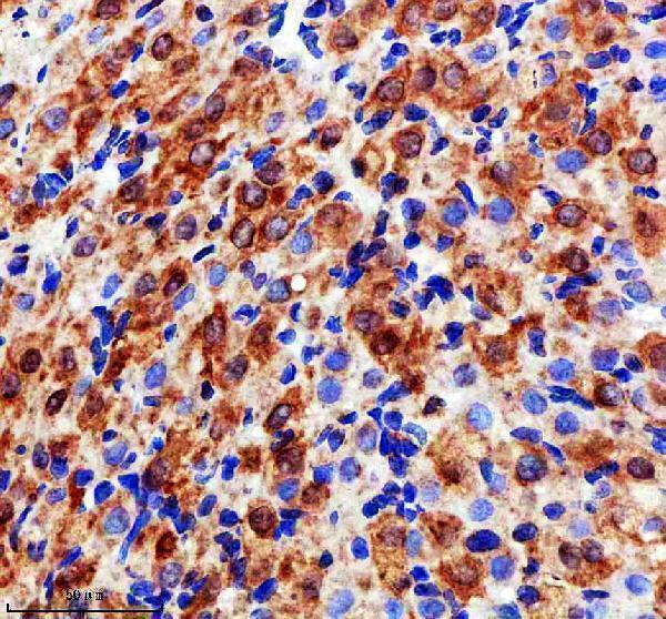 IHC analysis of EVC2 using anti-EVC2 antibody (A07088-1)