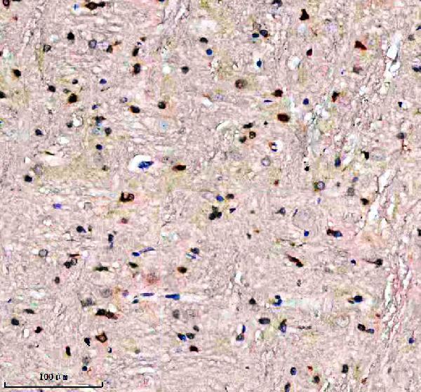 a07088 1 evc2 primary antibodies ihc testing 3