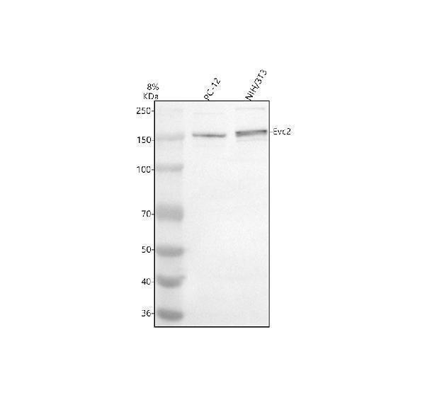 Western blot analysis of EVC2 using anti-EVC2 antibody (A07088-1)