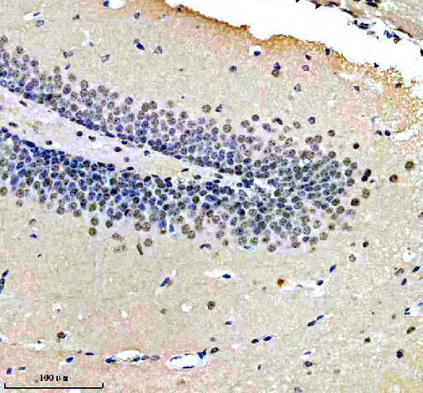 IHC analysis of NUP93 using anti-NUP93 antibody (A07090-1)