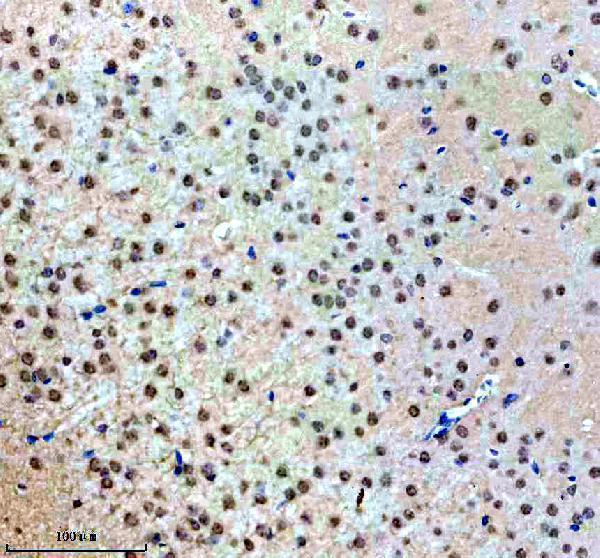 a07090 1 nup93 primary antibodies ihc testing 2