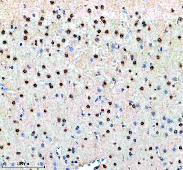 a07090 1 nup93 primary antibodies ihc testing 3