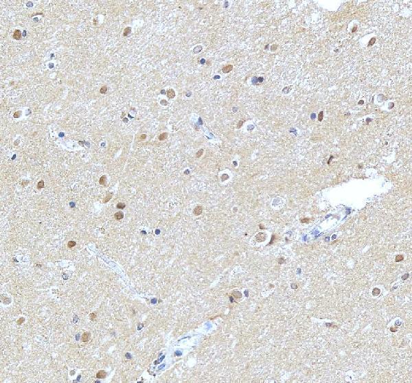 IHC analysis of NUP93 using anti-NUP93 antibody (A07090-1)