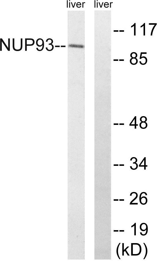 a07090 nup93 primary antibodies wb testing 1