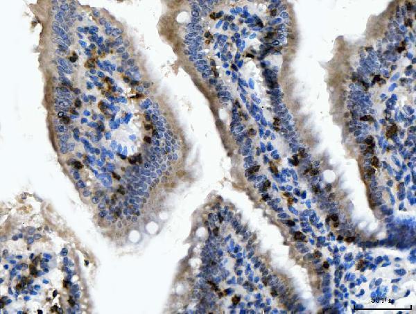  IHC analysis of CD103/Itgae using anti-CD103/Itgae antibody (A07091-2)
