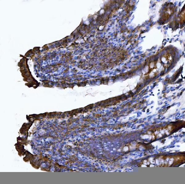 IHC analysis of CD103/Itgae using anti-CD103/Itgae antibody (A07091-2)