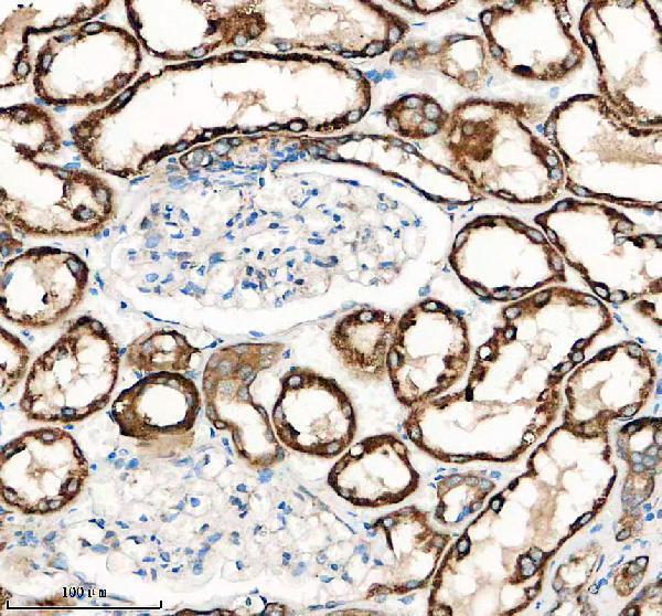 IHC analysis of FXYD2 using anti-FXYD2 antibody (A07096-1)