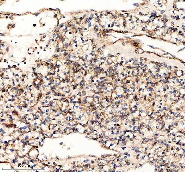 IHC analysis of FXYD2 using anti-FXYD2 antibody (A07096-1)