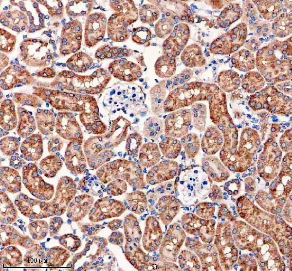 IHC analysis of FXYD2 using anti-FXYD2 antibody (A07096-1)