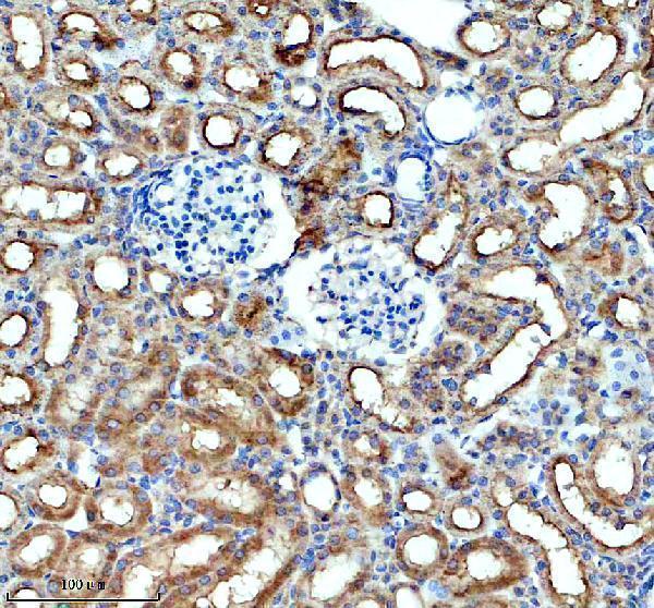 a07096 1 fxyd2 primary antibodies ihc testing 4