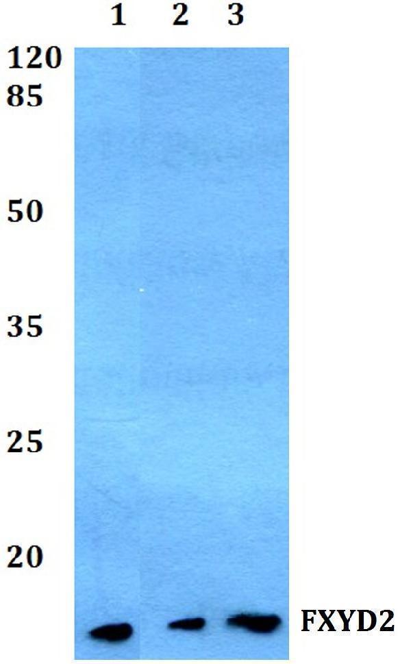 Western blot (WB) analysis of FXYD2 polyclonal antibody at 1:500 dilution
Lane1:HepG2 whole cell lysate
Lane2:Mouse lung tissue lysate
Lane3:Rat brain tissue lysate