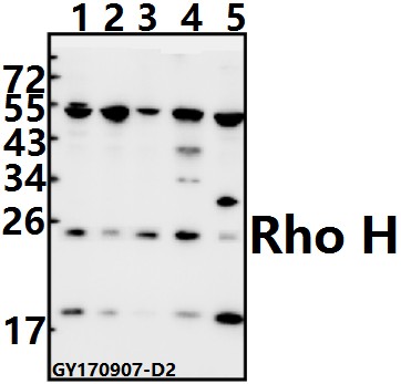 Western blot (WB) analysis of Rho H (M134) pAb at 1:500 dilution
Lane1:HEK293T whole cell lysate(20ug)
Lane2:HepG2 whole cell lysate(20ug)
Lane3:Hela whole cell lysate(20ug)
Lane4:C6 whole cell lysate(40ug)
Lane5:CT26 whole cell lysate(40ug)